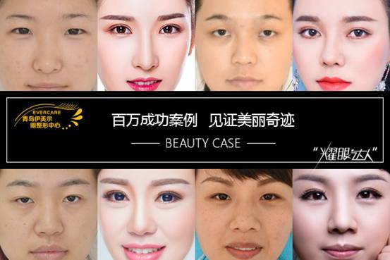 青岛伊美尔杨文国:眼睛一个单眼皮,一个双眼皮