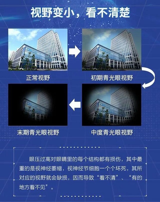 世界青光眼周|视神经一张照,青光眼早知道,眼健康检查