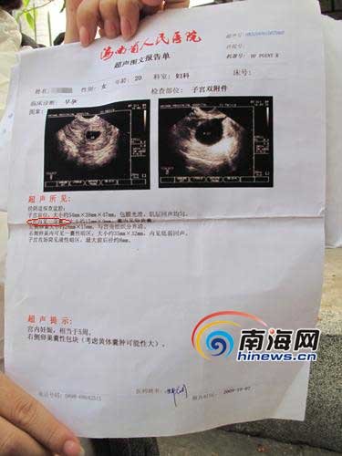 王小姐10月7日的b超显示是腹中只有一婴 (南海网记者 陈望摄)