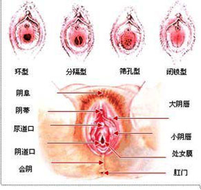 处女膜在什么样的位置?怎么修补?-青岛新闻网