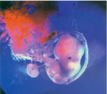 有妇科炎症怀孕了怎么办?