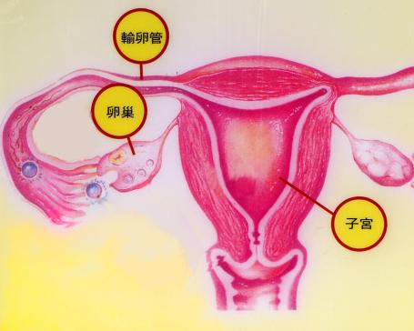 卵巢肿瘤影响月经吗