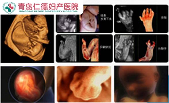 传统b超只能对胎儿的生理指标进行检测,而四维彩超可以对胎儿的