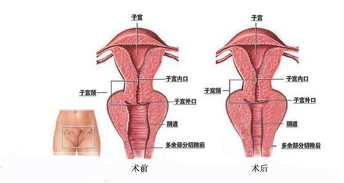 青岛做阴道紧缩术医院哪家好?推荐新阳光韩式