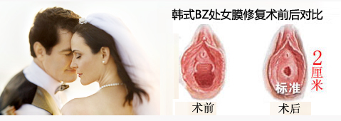 青岛处女膜修复 首选新阳光韩式BZ处女膜修复