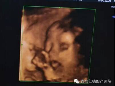 【婷婷孕周记】孕24周:四维彩超,宝宝吐舌头