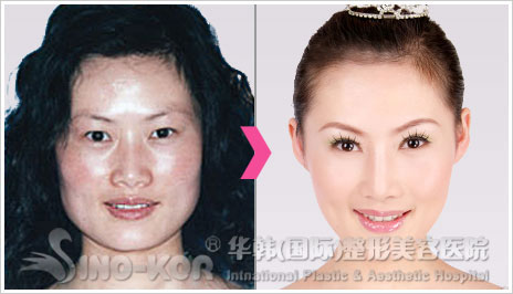 青岛最好的祛斑医院--华韩整形美容医院