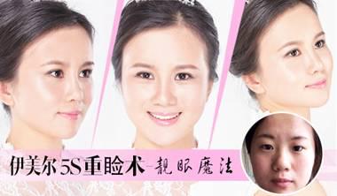 青岛专业韩式微创双眼皮医院