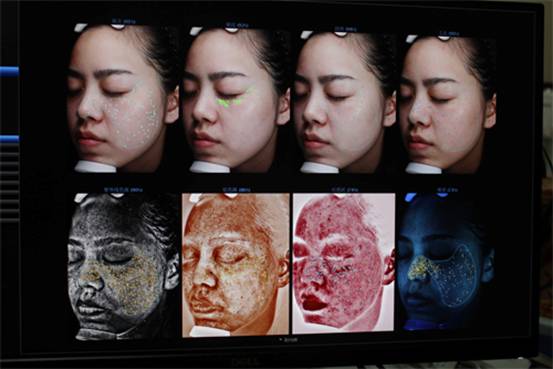 水光针,中胚层疗法,是皮肤给水的源泉!