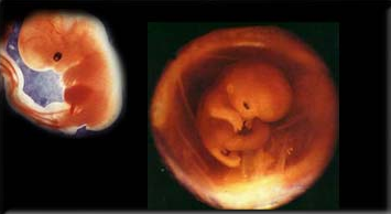 怀孕一个月胎儿大小