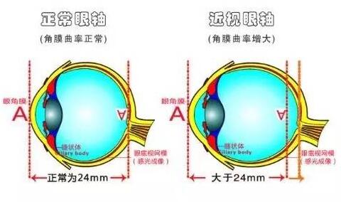 7e1f183e-b026-4aff-9eeb-2ef14e842ddd.jpg