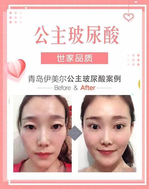 267d5a4a-36f0-481a-a686-adb2c3270b99.jpg