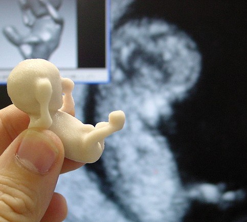 怀孕12周 胎儿多大正常 怀孕12周的胎儿胎长约为9cm,胎重约为23g怀孕