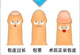 怎么算排尿困难 f0def10d8dca12bb4ad70a.jpg