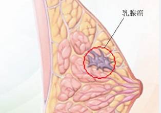 乳腺医院排名_乳腺科医院照片(2)