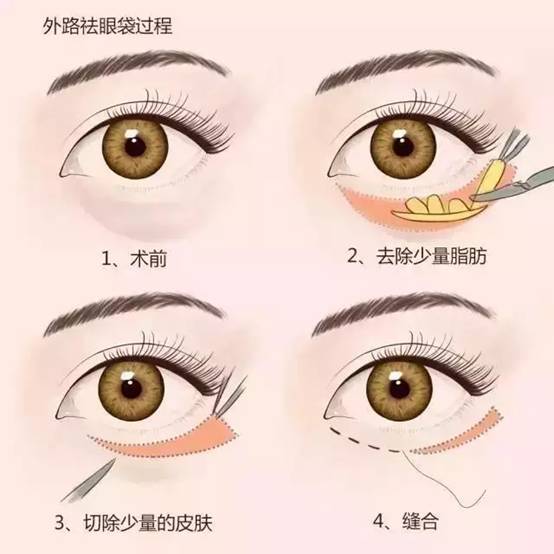 60a44c00a1b71a10dcb24c.jpg