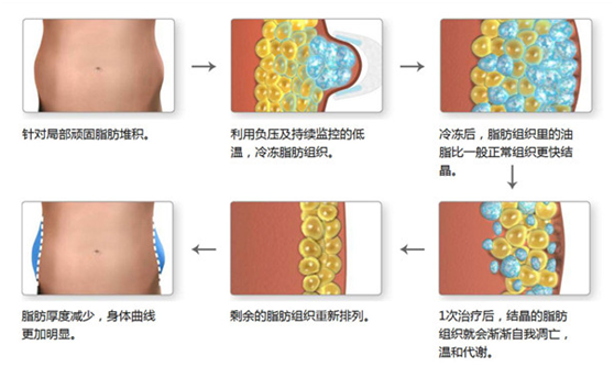 2cd05a36f1211a838ccd0d.png